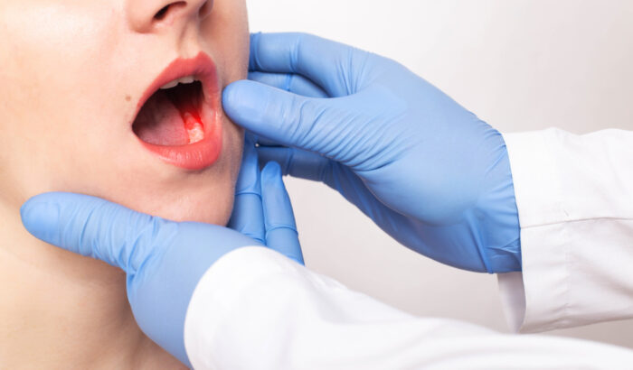 Dentist,Doctor,Examines,The,Bite,Of,The,Jaw,Of,A